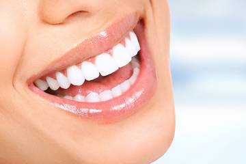 cholla-family-dentsitry-scottsdale-teeth-whitening