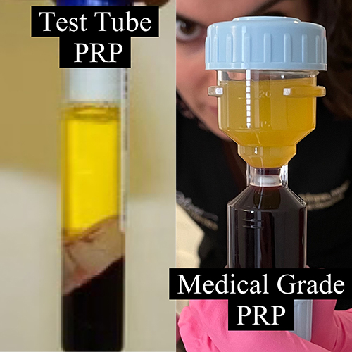 test-tube-prp-vs-medical-grade-prp